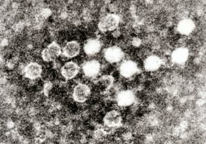 Blood Parvovirus_in_Blood