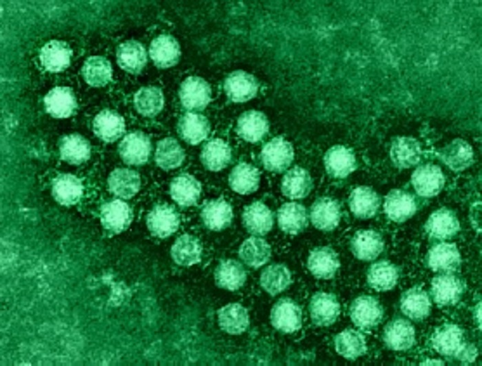 enterovirus71