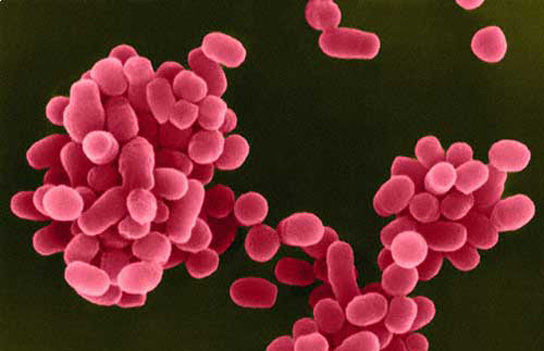 brucella-bacterium micrografia electrònica acolorida